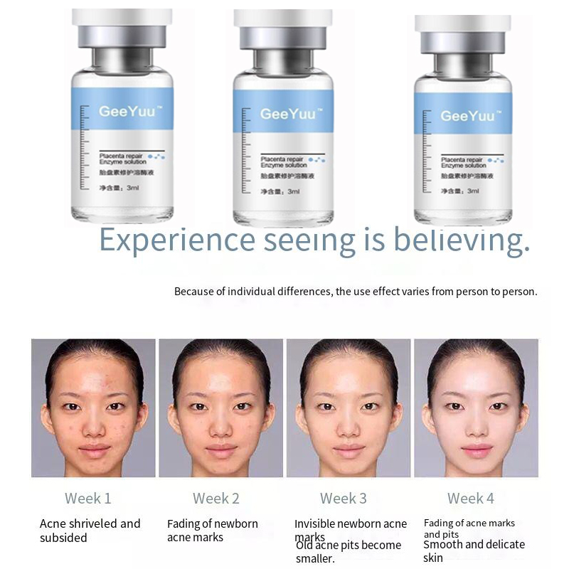 Serum Asam Hyaluronik Ampul Pe - Placenta Extract Serum ulasan dan harga